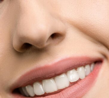 De nieuwste beautytrend, investeren in je glimlach