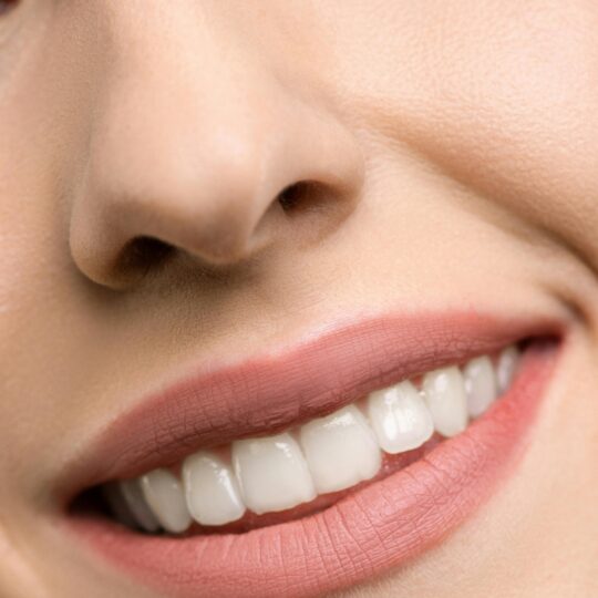 De nieuwste beautytrend, investeren in je glimlach