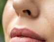 Lipfillers: wat zijn de do's en don'ts?