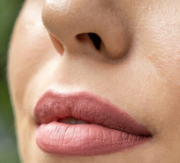Lipfillers: wat zijn de do's en don'ts?