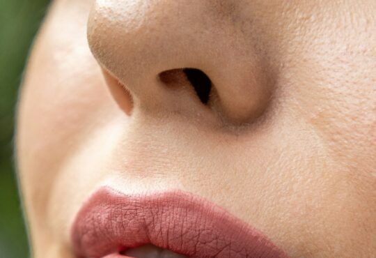 Lipfillers: wat zijn de do's en don'ts?
